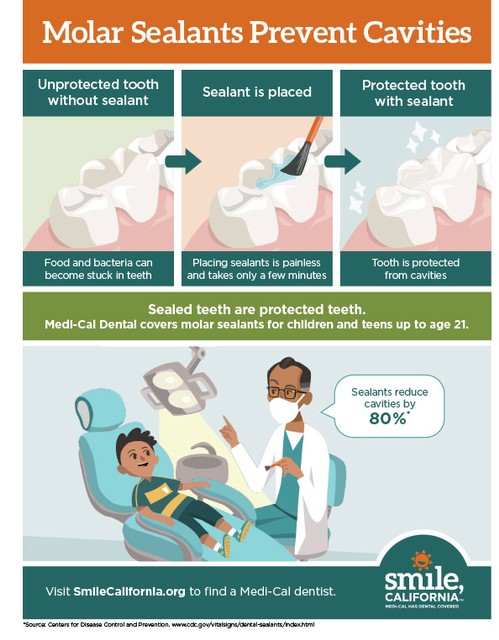 Molar Sealants Prevent Cavities