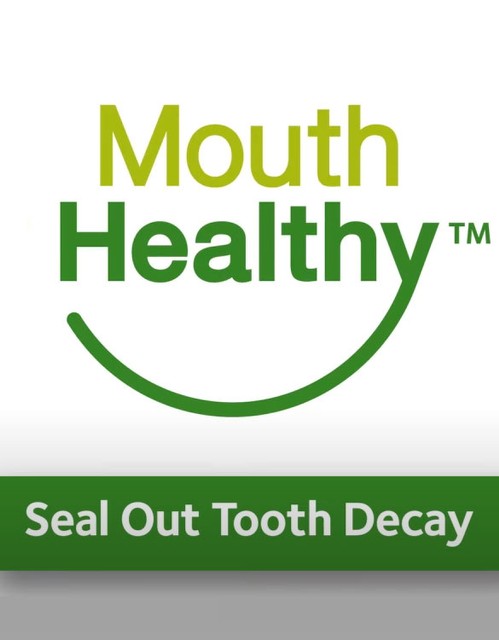 Seal Out Tooth Decay