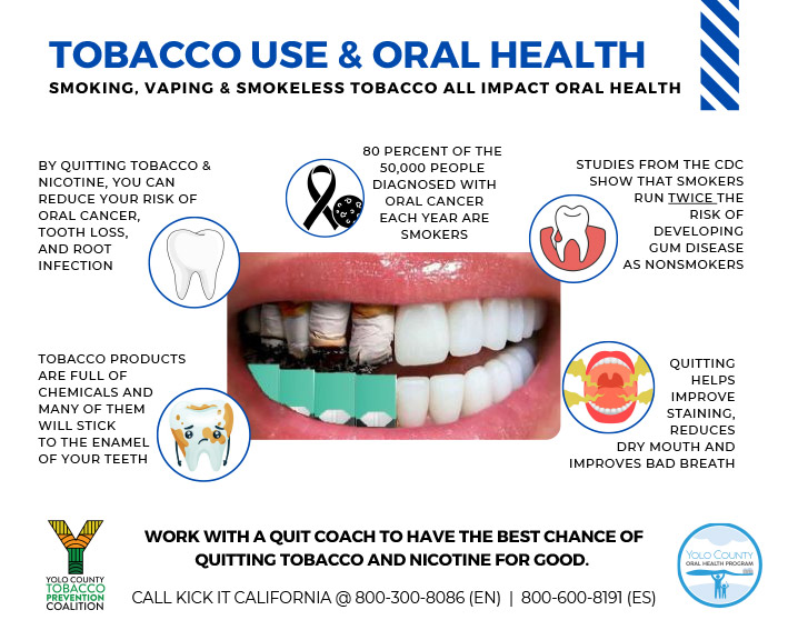 Tobacco Use and Oral Health Diagram